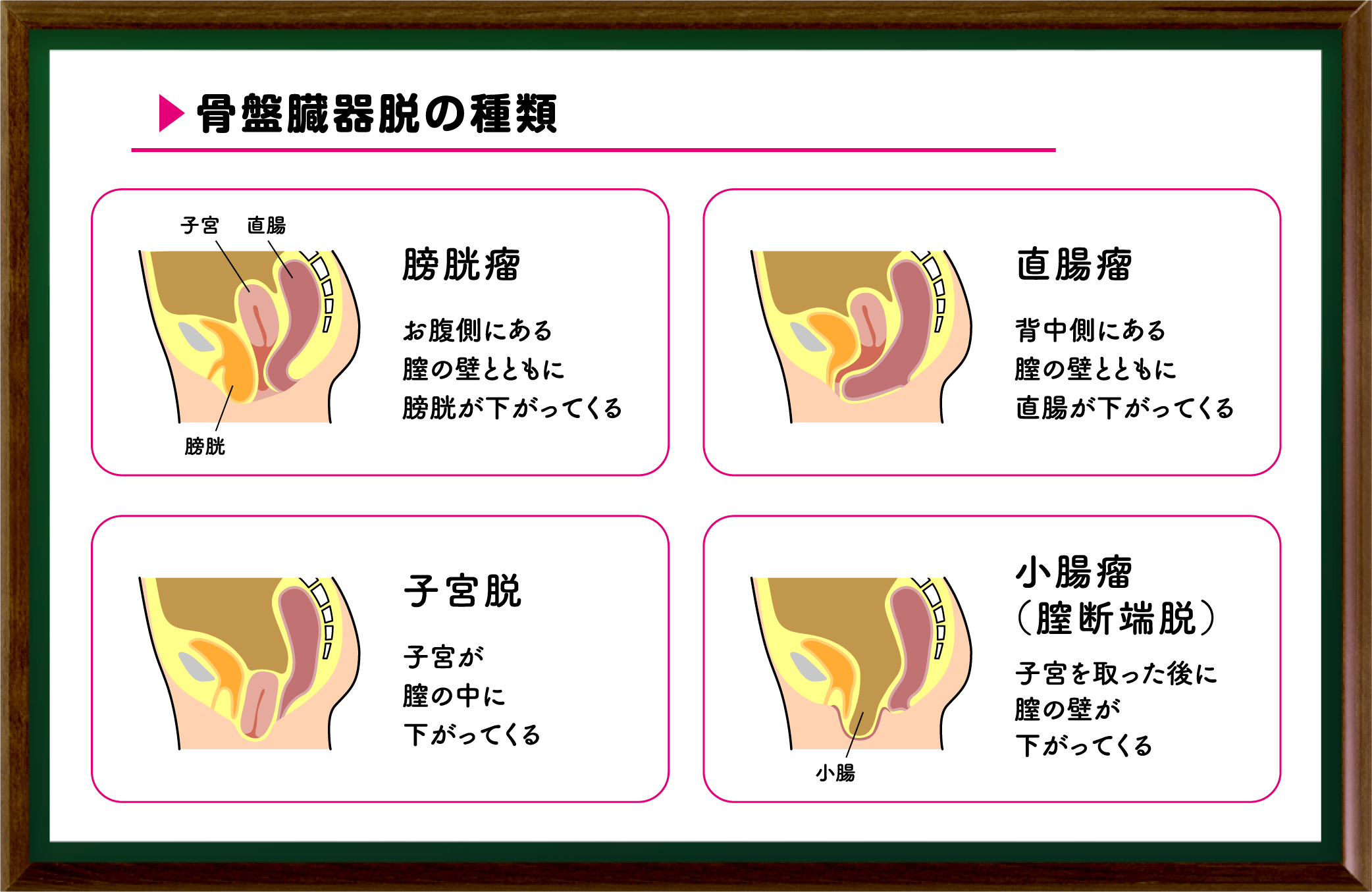 膣 の 中 コリコリ